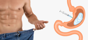 هزینه بوتاکس معده در تهران