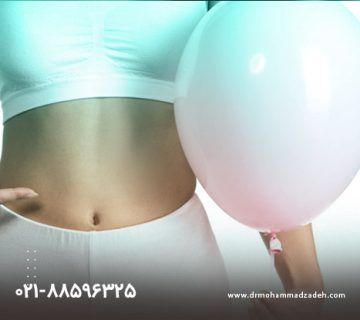 هزینه بالون گذاری معده