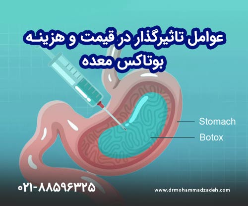 عوامل تاثیرگذار در قیمت و هزینه بوتاکس معده