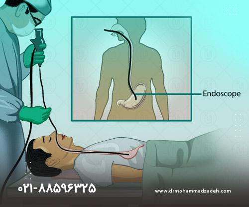 دکتر مرکز آندوسکوپی دکتر محمد علی محمد زاده