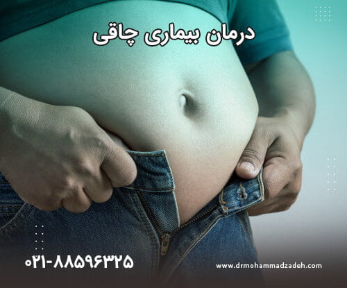 درمان بیماری چاقی با رژیم و بالون معده و یا بوتاکس معده