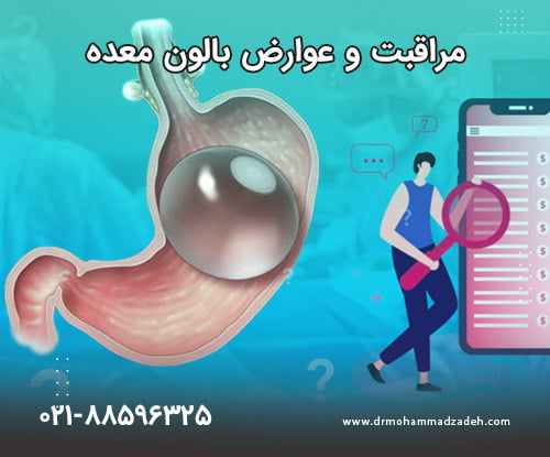 مراقبت و عوارض بالون معده