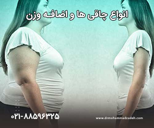 انواع چاقی ها و اضافه وزن