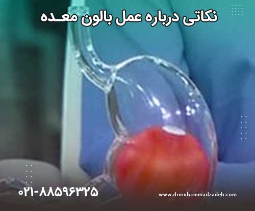 نکاتی درباره عمل بالون معده