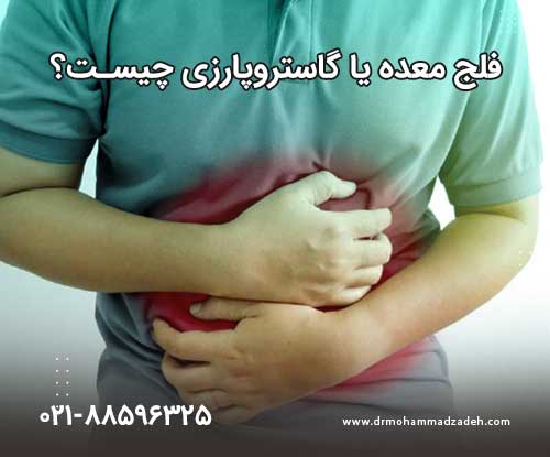 فلج معده یا گاستروپارزی