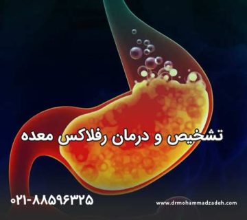تشخیص و درمان رفلاکس معده