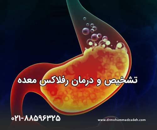 تشخیص و درمان رفلاکس معده