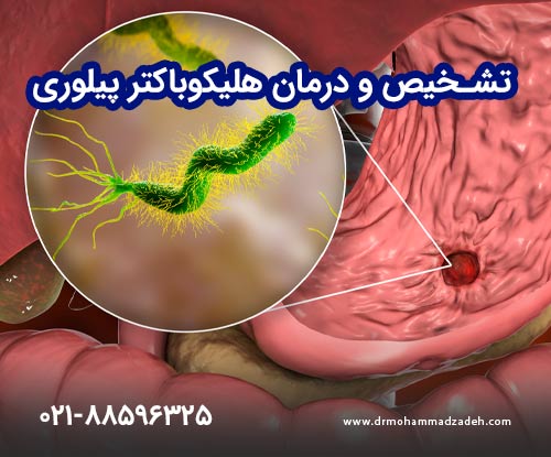 تشخیص و درمان هلیکوباکتر پیلوری