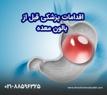 اقدامات پزشکی قبل بالون معده