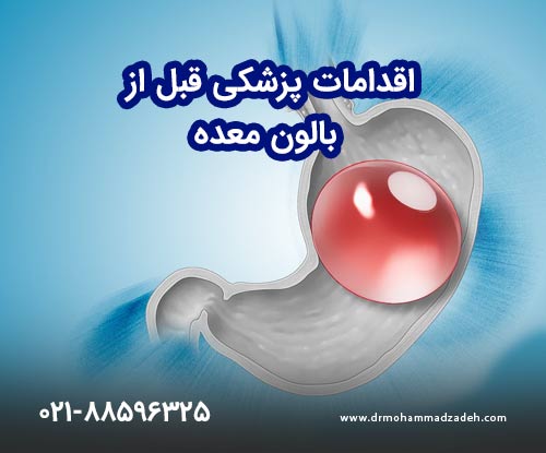 اقدامات پزشکی قبل بالون معده