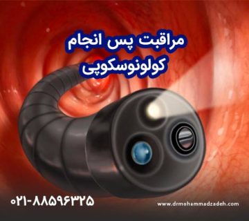 مراقبت پس از تزریق کولونوسکوپی روده