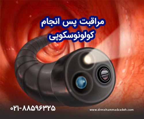 مراقبت پس از تزریق کولونوسکوپی روده