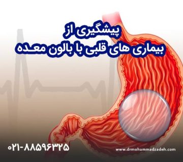 پیشگیری از بیماری های قلبی با بالون معده