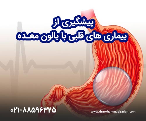 پیشگیری از بیماری های قلبی با بالون معده