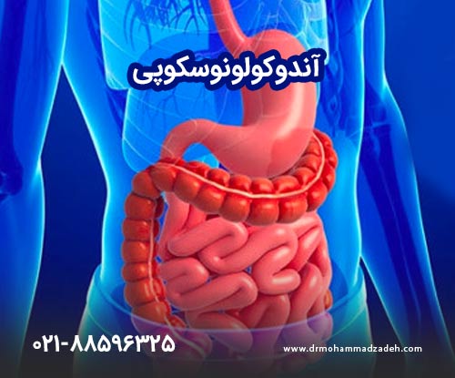 آندوکولونوسکوپی