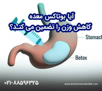 آیا بوتاکس معده کاهش وزن را تضمین می کند؟