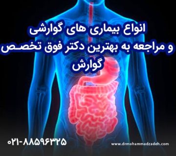 انواع بیماری های گوارشی و مراجعه به بهترین دکتر فوق تخصص گوارش