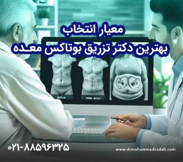 معیار انتخاب بهترین دکتر تزریق بوتاکس معده