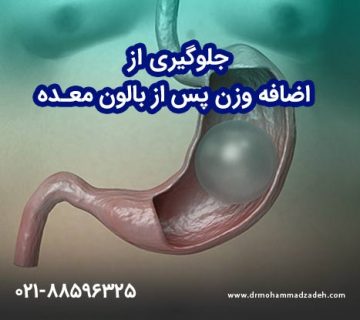 جلوگیری از اضافه وزن پس از بالون معده