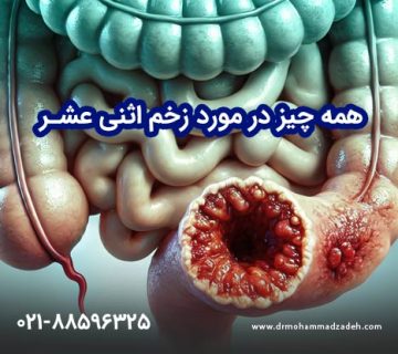 همه چیز در مورد زخم اثنی عشر