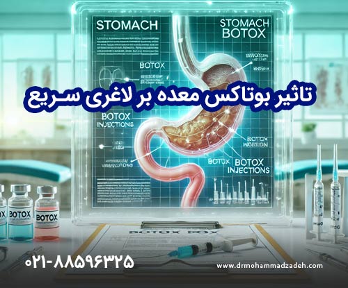 تاثیر بوتاکس معده بر لاغری سریع