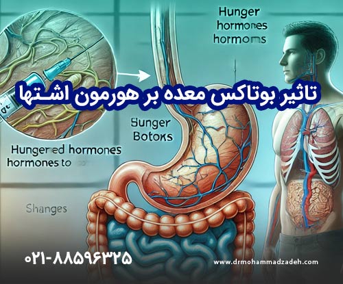 تغییرات هورمونی ناشی از بوتاکس معده و تأثیر آن بر اشتها