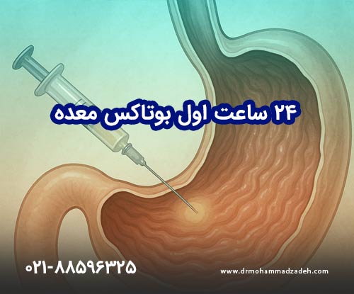 ۲۴ ساعت اول بوتاکس معده