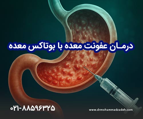 درمان عفونت معده با بوتاکس معده