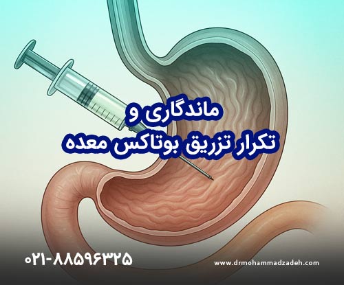 ماندگاری و تکرار تزریق بوتاکس معده