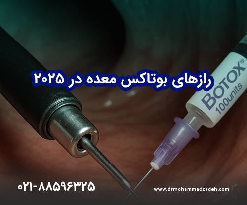 سوال طلایی قبل از تزریق بوتاکس معده