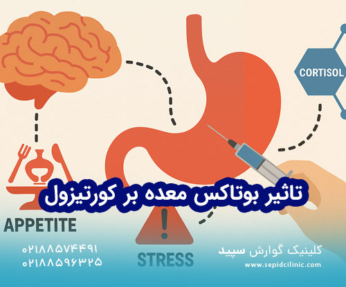 تاثیر بوتاکس معده بر کورتیزول