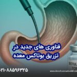فناوری های جدید در تزریق بوتاکس معده