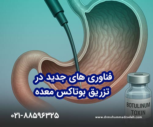 فناوری های جدید در تزریق بوتاکس معده