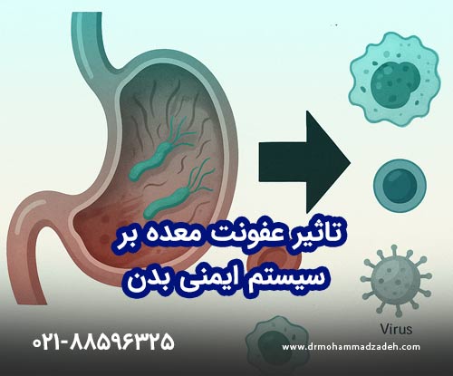عفونت معده و تأثیر آن بر سیستم ایمنی بدن