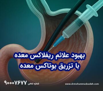 بهبود علائم ریفلاکس معده با تزریق بوتاکس معده