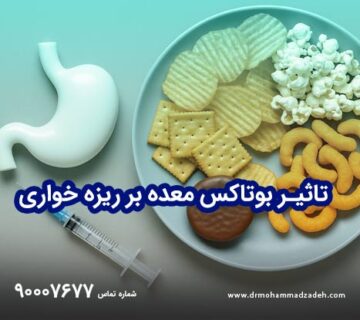 درمان ریزه خواری با بوتاکس معده