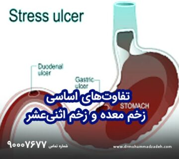 تفاوت‌های اساسی زخم معده و زخم اثنی‌عشر