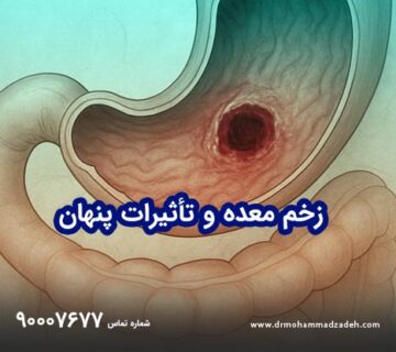 زخم معده و تأثیرات پنهان آن بر سلامت روان