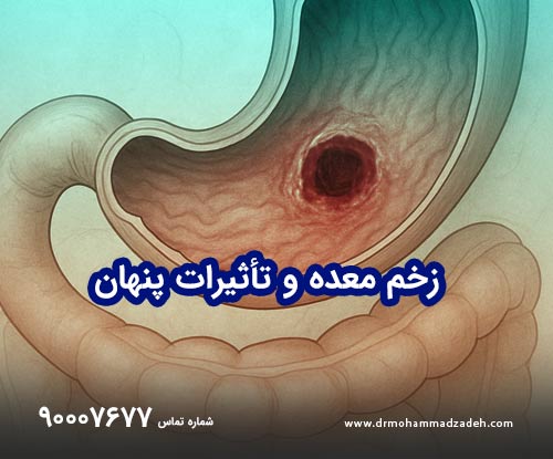 زخم معده و تأثیرات پنهان آن بر سلامت روان