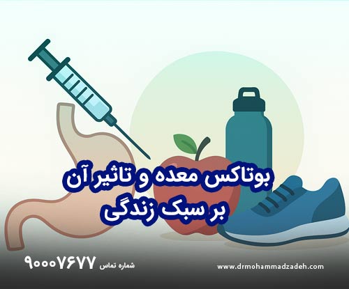 بوتاکس معده و تاثیر آن بر سبک زندگی