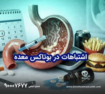 اشتباهات در بوتاکس معده