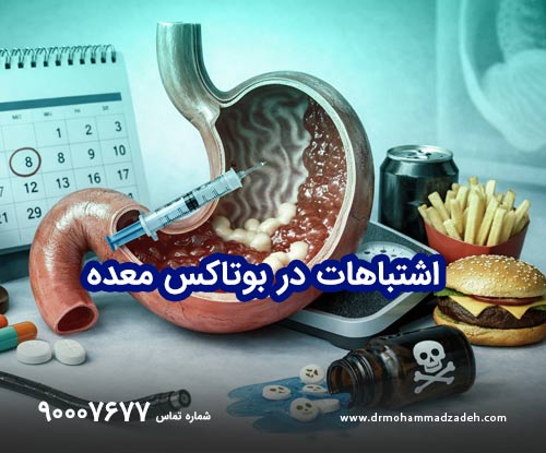 اشتباهات در بوتاکس معده