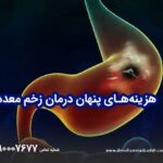 بررسی هزینه‌های پنهان درمان زخم معده