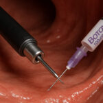 نکاتی کاربردی برای زندگی با زخم معده