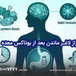 راز لاغری ماندگار بعد از بوتاکس معده