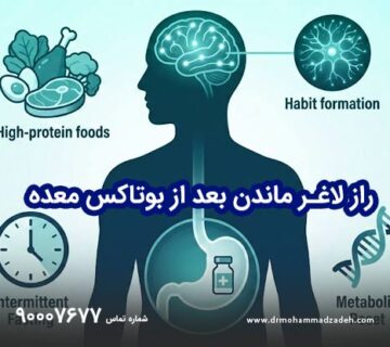راز لاغری ماندگار بعد از بوتاکس معده
