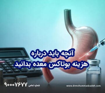 آنچه باید درباره هزینه بوتاکس معده بدانید
