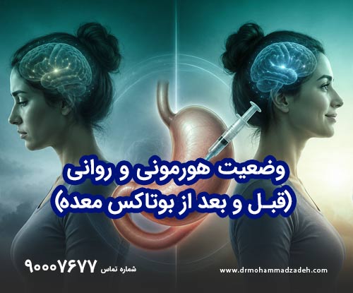 تأثیرات بر خلق و خواب با بوتاکس معده