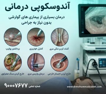 آندوسکوپی درمانی چیست