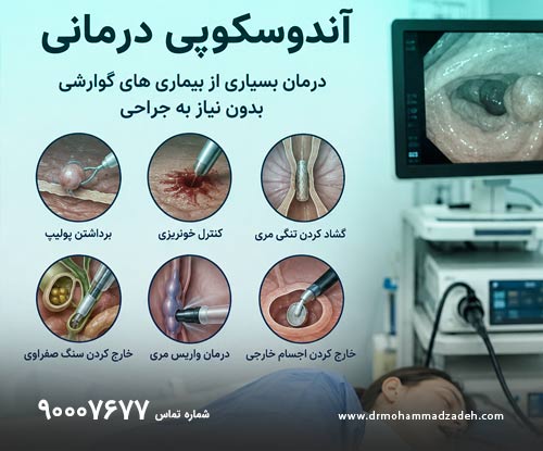 آندوسکوپی درمانی چیست